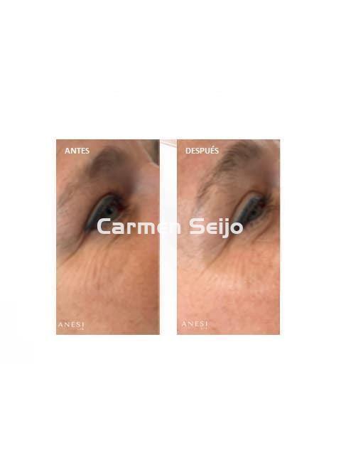 Anesi Lab Contorno de Ojos 3C Vitamin Glow Eye Bright Serum - Imagen 2