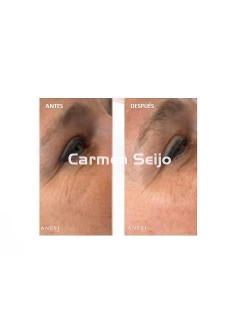 Anesi Lab Contorno de Ojos 3C Vitamin Glow Eye Bright Serum - Imagen 2