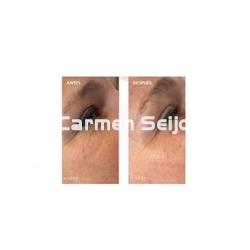 Anesi Lab Contorno de Ojos 3C Vitamin Glow Eye Bright Serum - Imagen 2