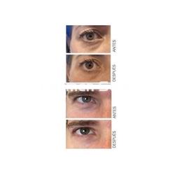 Anubis Contorno de Ojos Whitening Shining Line - Imagen 2