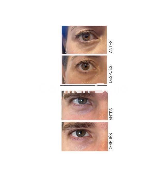 Anubis Contorno de Ojos Whitening Shining Line - Imagen 3