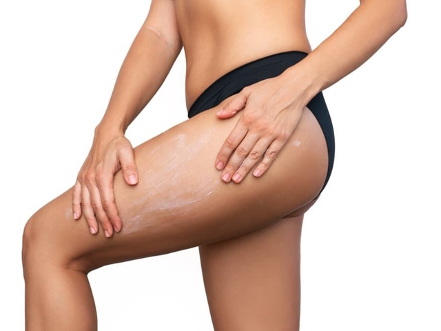 Cómo combatir la celulitis y la flacidez con nuestros tratamientos reductores y reafirmantes