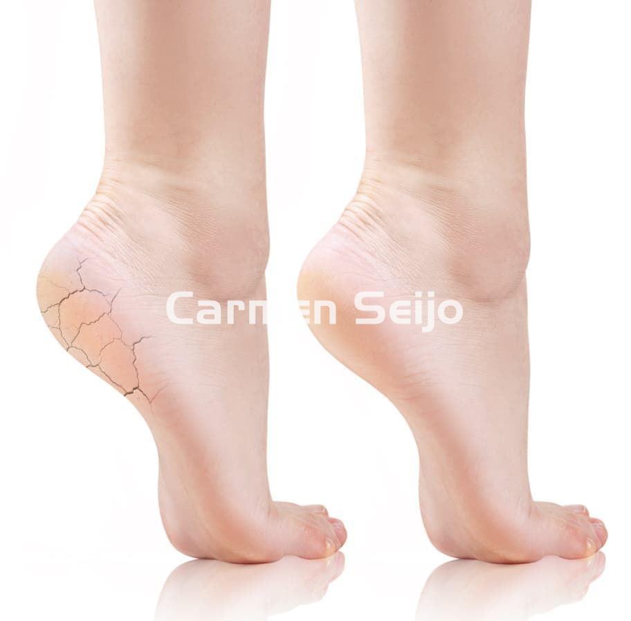 FeetCalm Mousse Talones Agrietados 25% Urea - Imagen 2