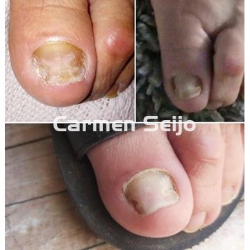 FeetCalm Spray SOS Reparador de Uñas - Imagen 2