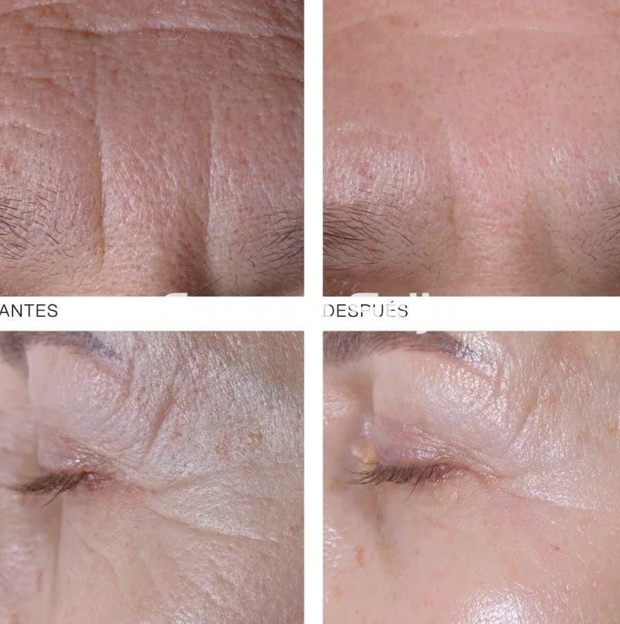 Germaine de Capuccini Pack Pro-Colágeno Crema SPF30 RICH y Contorno Timexpert Wrink·Less - Imagen 2