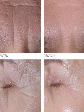 Germaine de Capuccini Pack Pro-Colágeno Crema SPF30 RICH y Contorno Timexpert Wrink·Less - Imagen 2