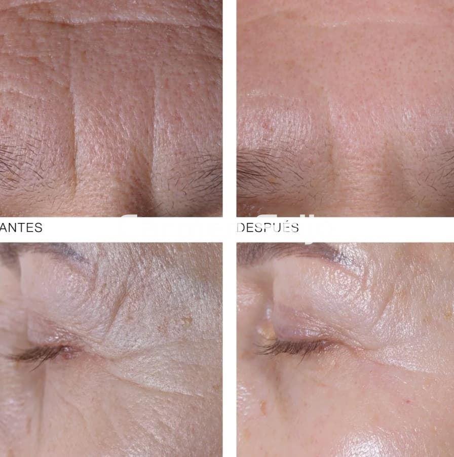 Germaine de Capuccini Rutina Antiarrugas Pro-Colágeno SPF30 SOFT Timexpert Wrink·Less - Imagen 2